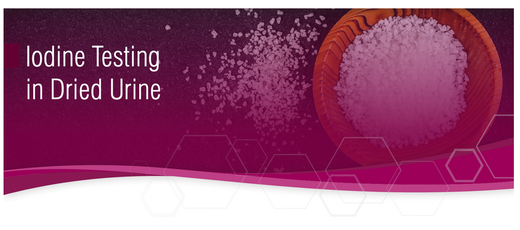 Why You Should Test Your Iodine Levels