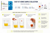 Sleep Hormone Test (UDH I)